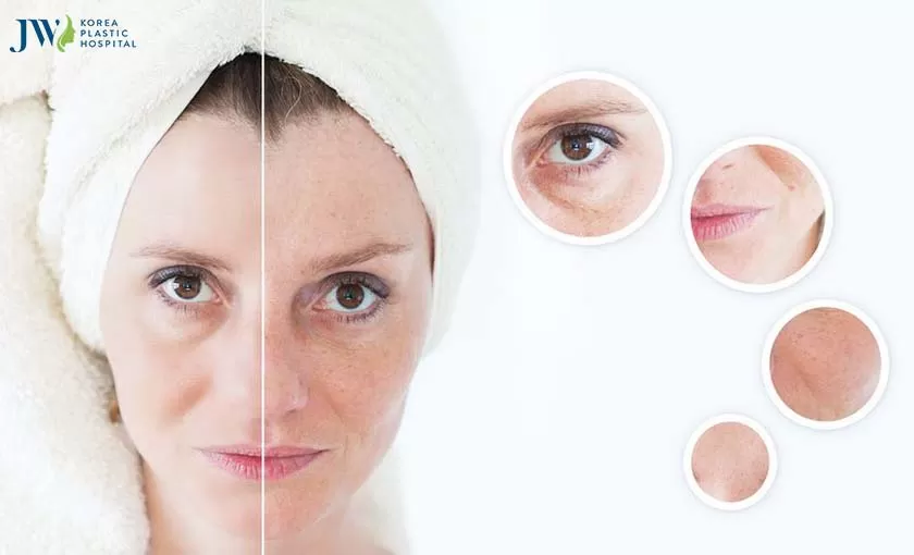 Cải lão gương mặt 3M có thể thực hiện cho những người U30 không?
