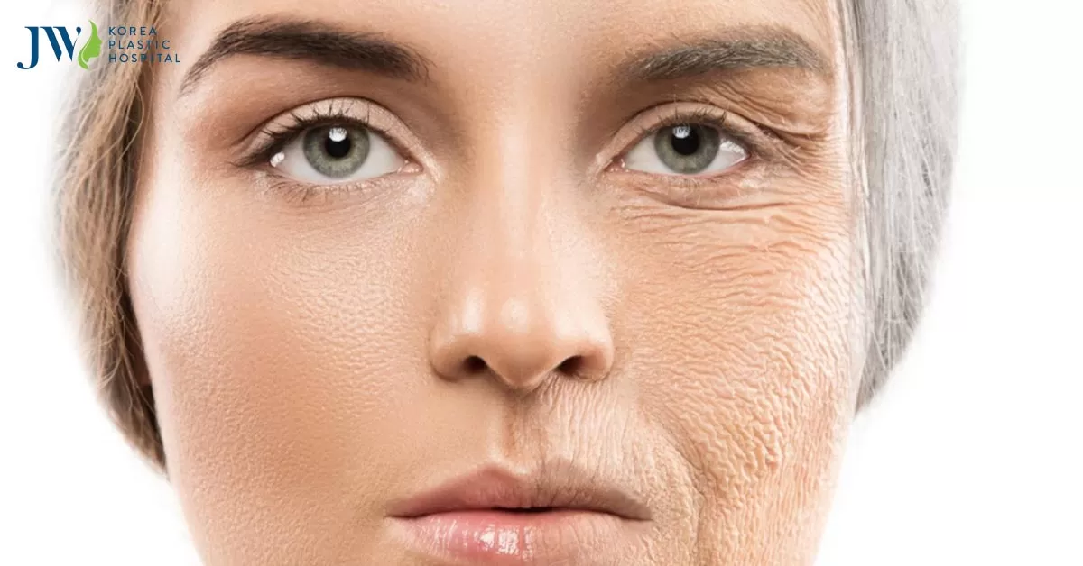 Cải lão gương mặt 3M có để lại sẹo không? Có duy trì dài lâu không?