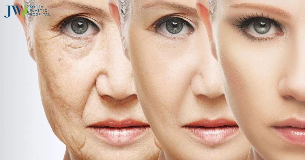 Cải lão gương mặt 3M tại bệnh viện JW lấy lại vẻ đẹp không tuổi