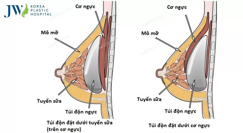 nang nguc bao lau thi mem 2