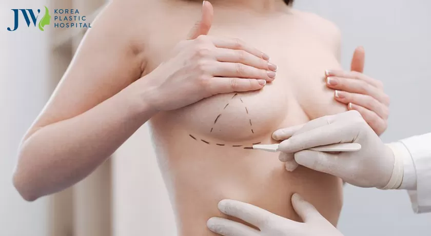 Nâng ngực nội soi đường rốn