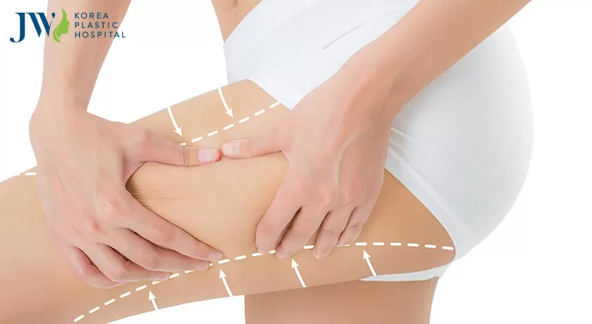 căng da đùi đẹp tự nhiên