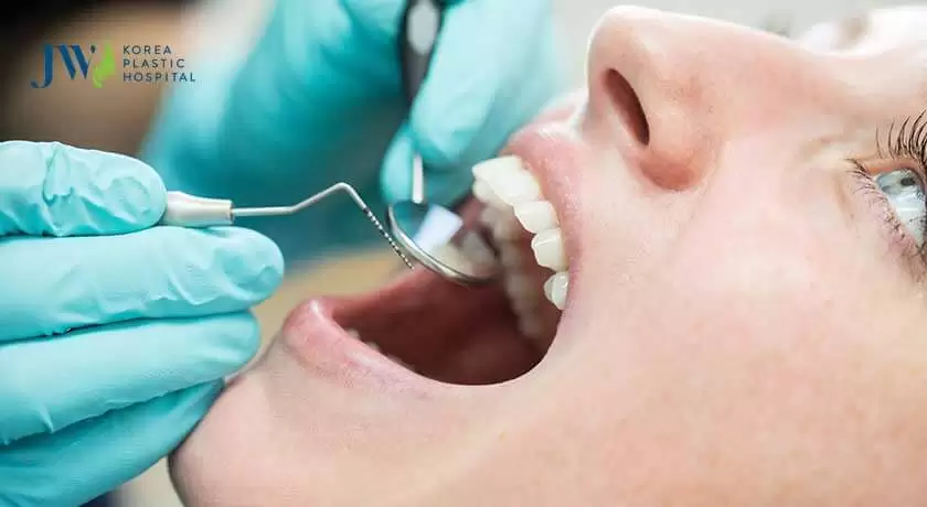 bọc răng sứ kỹ lưỡng