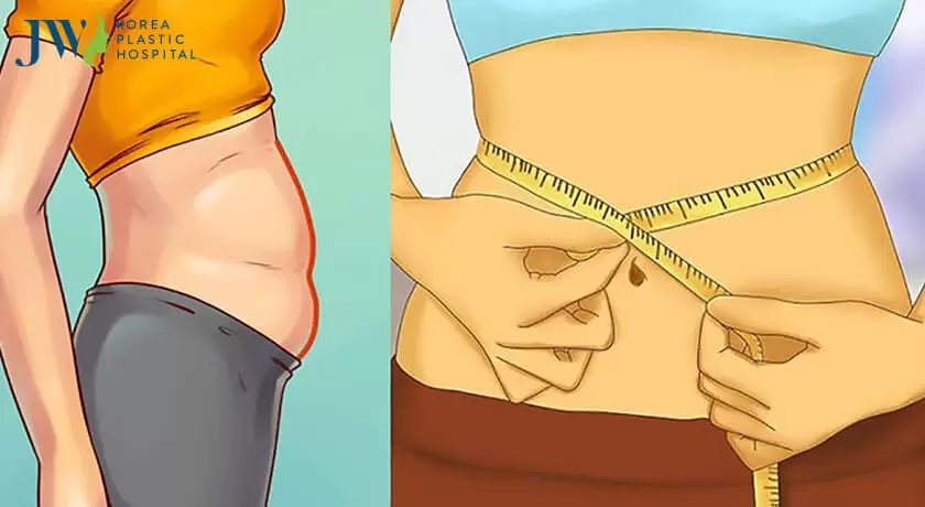 Sự khác biệt khi căng da bụng