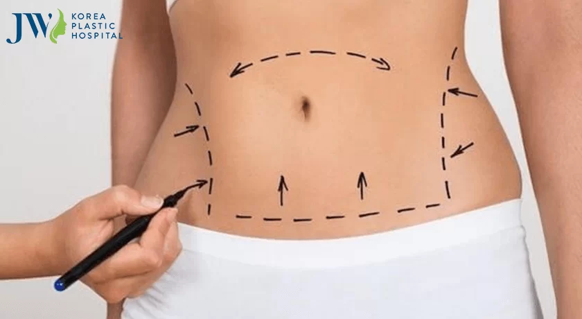 Đo vẽ trước khi phẫu thuật sẽ mang lại hiệu quả cao.