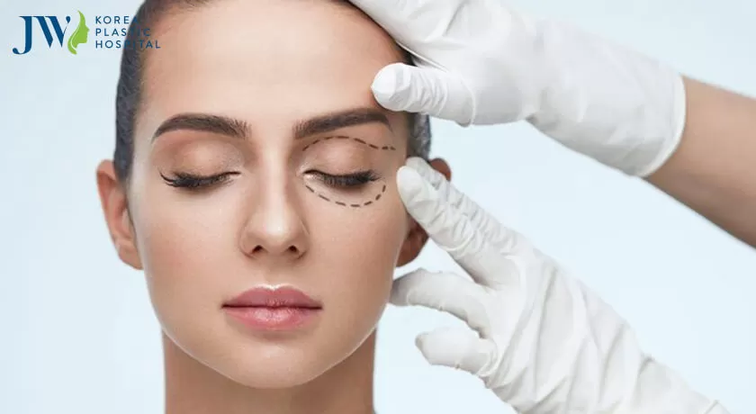 Lấy mỡ mắt được nhiều chị em tin dùng làm đẹp đôi mắt hiện nay.