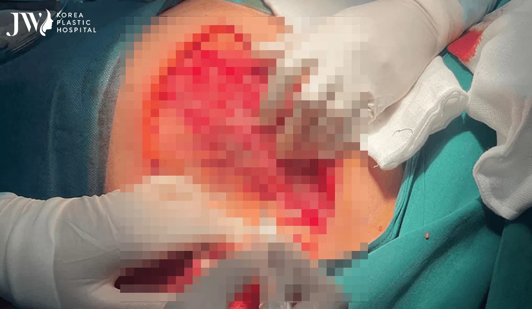 Mấy ai thấu hiểu được cảm xúc của người đang lâm nguy?