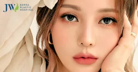 cắt mí mắt đẹp