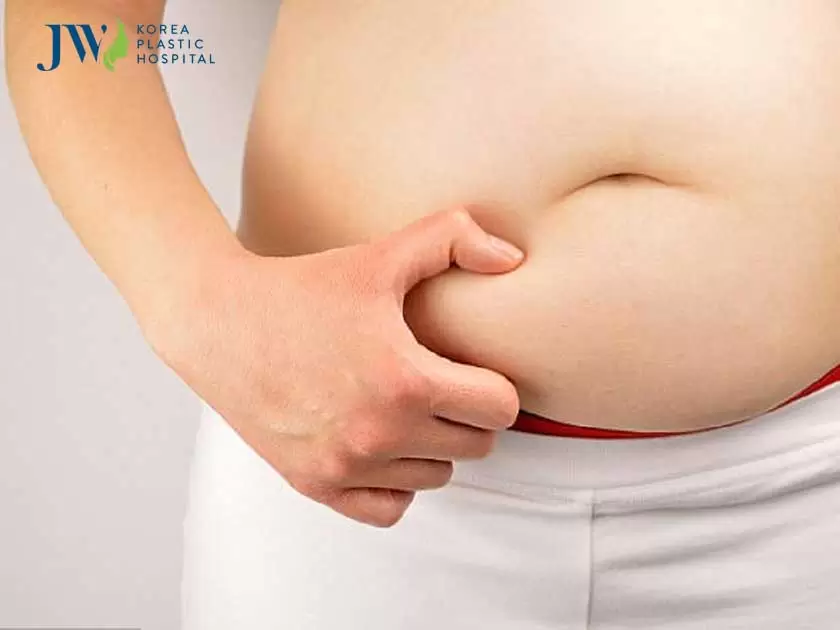 Hút mỡ bụng bao lâu thì đẹp