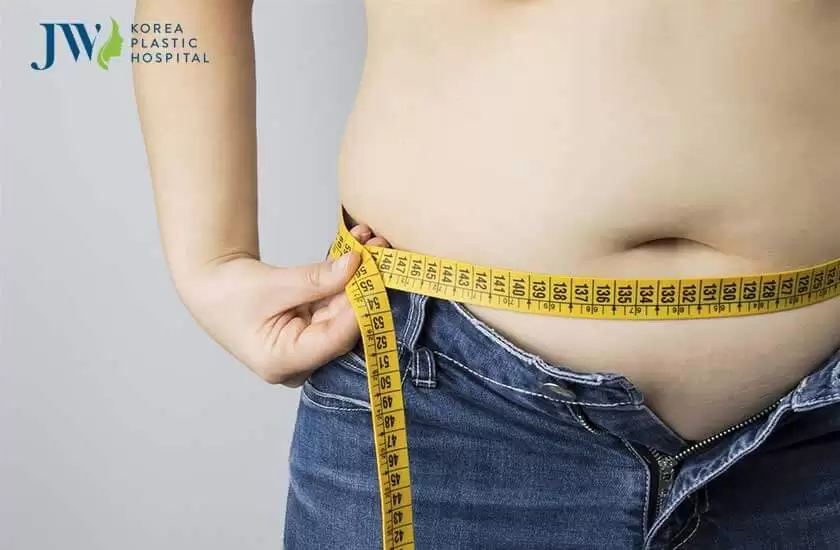 Hút mỡ bụng bao lâu thì đẹp