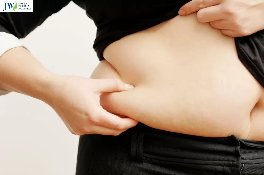 hút mở bụng có béo lại không