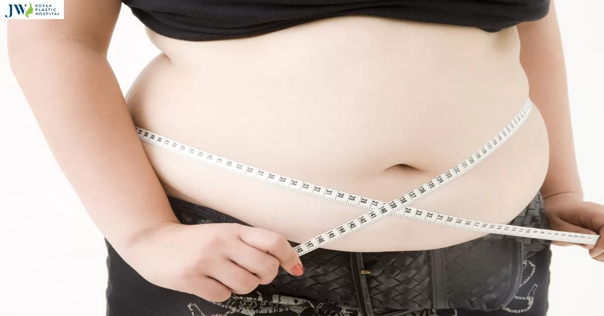 Hút mỡ bụng xong có bị béo lại không? Bác sĩ giải đáp