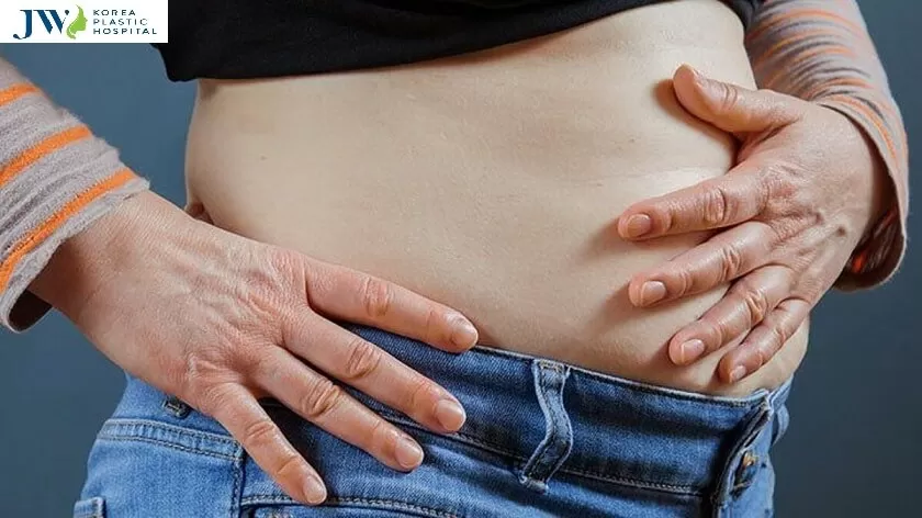 Phương pháp hút mỡ toàn thân bằng công nghệ Body Jet