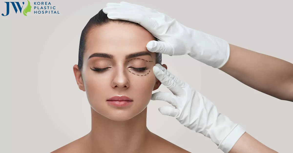 Lấy mỡ mí mắt trên có cần thiết hay không và thực hiện ở đâu uy tín?