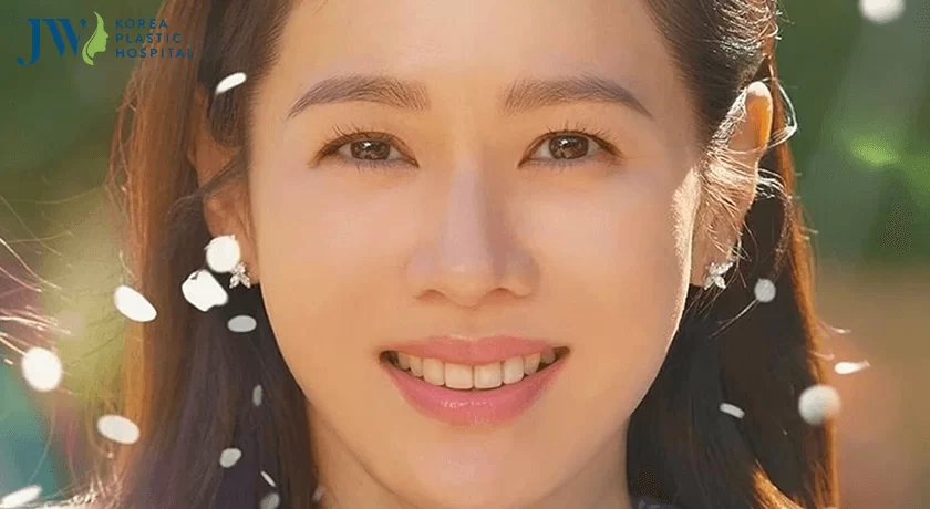 Mắt cười là gì