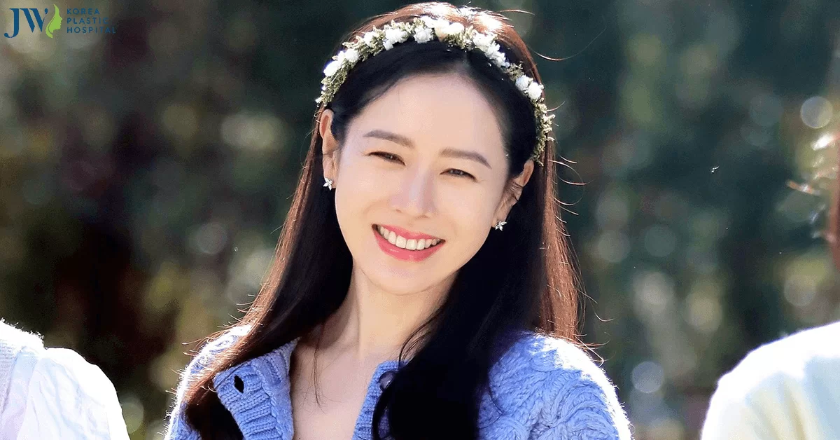 Mắt cười là gì? Tại sao mắt cười lại được lòng chị em như vậy?