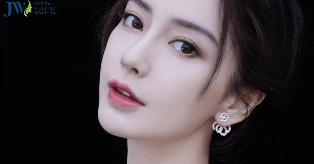 Mắt lồi có nên cắt mí không? Trường hợp nào thì có thể cắt mí được?