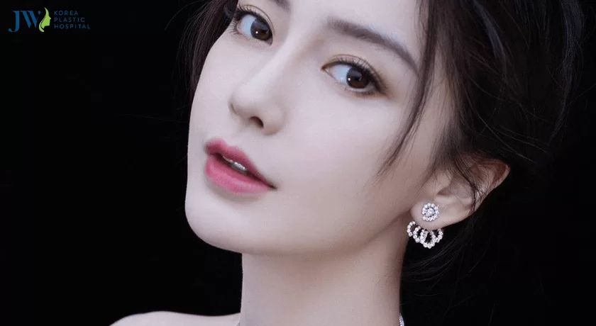 Mắt ốc nhồi là gì