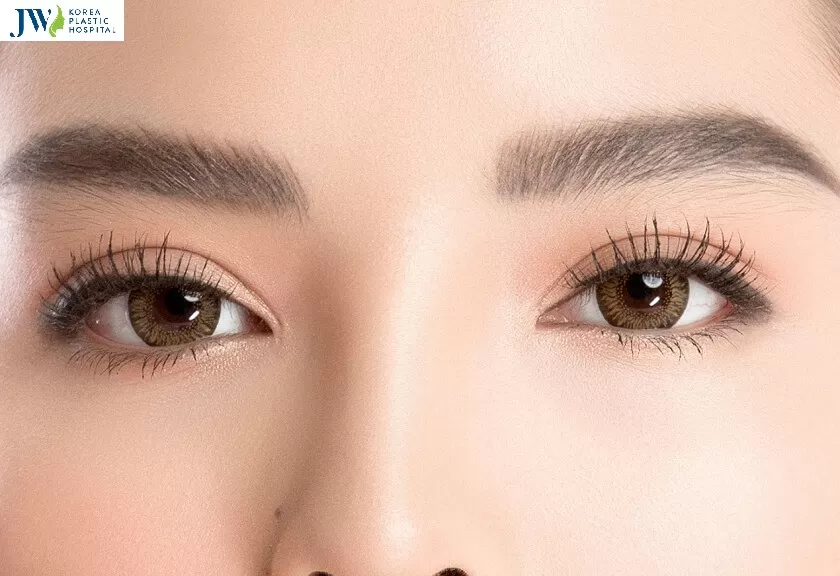 Hình ảnh sụp mí mắt