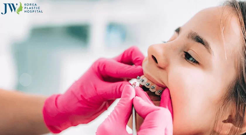 niềng răng từ sớm là rất tốt cho trẻ