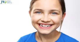 Niềng răng từ sớm