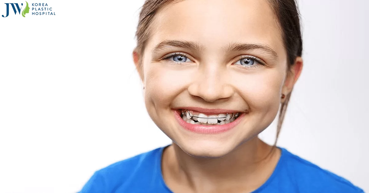 5 lý do mà cha mẹ cần đưa con cái đi niềng răng từ sớm
