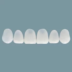 Mặt dán sứ<br>Veneer Emax 