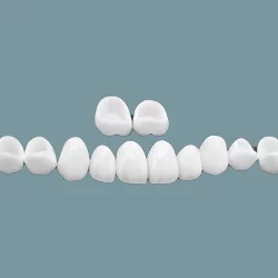 Mão toàn sứ<br>Veneer Lisi 
