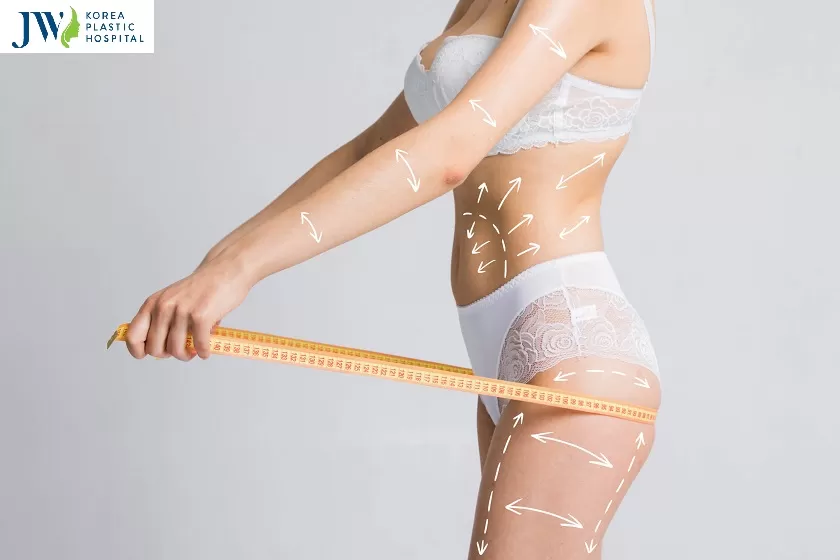 Hút mỡ bụng cấy mông có an toàn không