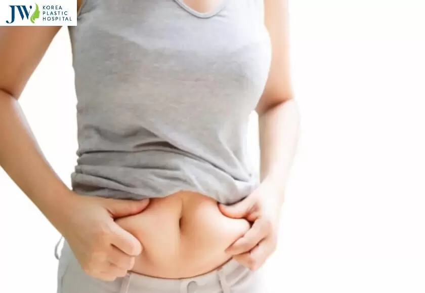 Trước khi thực hiện hút mỡ bụng cần chuẩn bị điều gì?