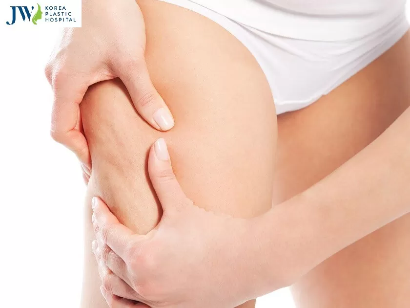 hút mỡ đùi bao nhiêu tiền