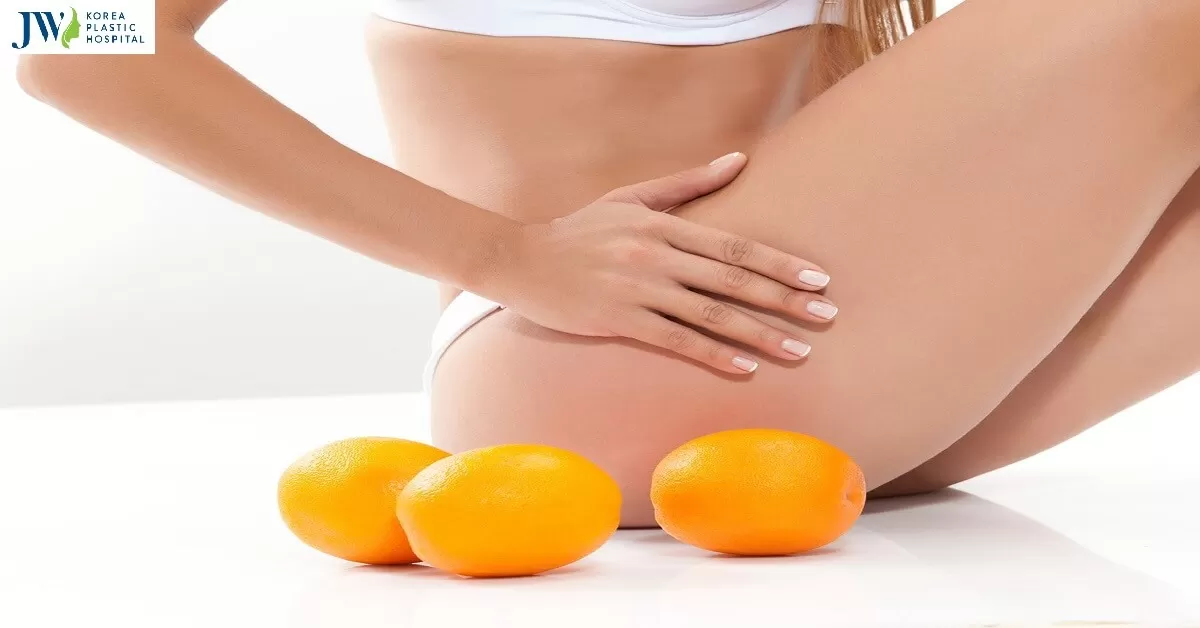 Hút mỡ đùi có giá bao nhiêu tiền mới đảm bảo an toàn sức khỏe