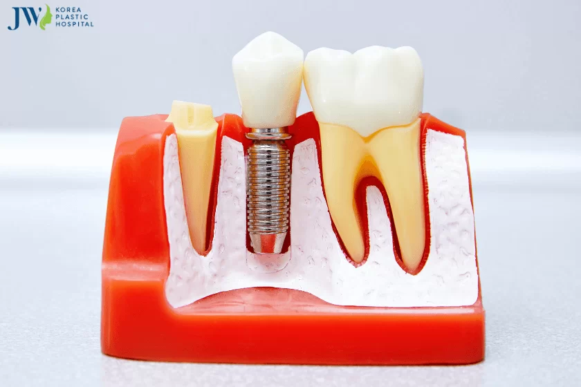 Ứng dụng của màng tế bào PRP