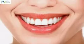 Chỉnh hàm hô không phẫu thuật