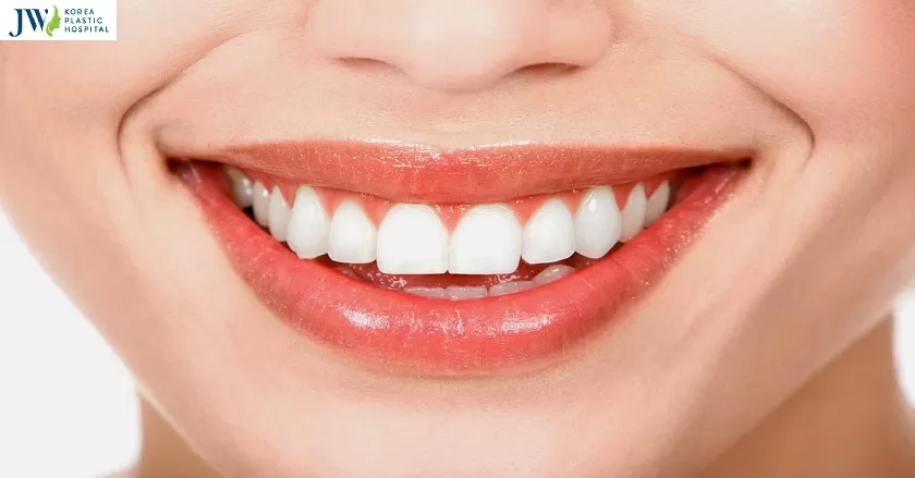 Chỉnh hàm hô không phẫu thuật
