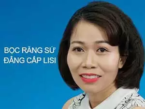 Bọc răng sứ đẳng cấp Lisi