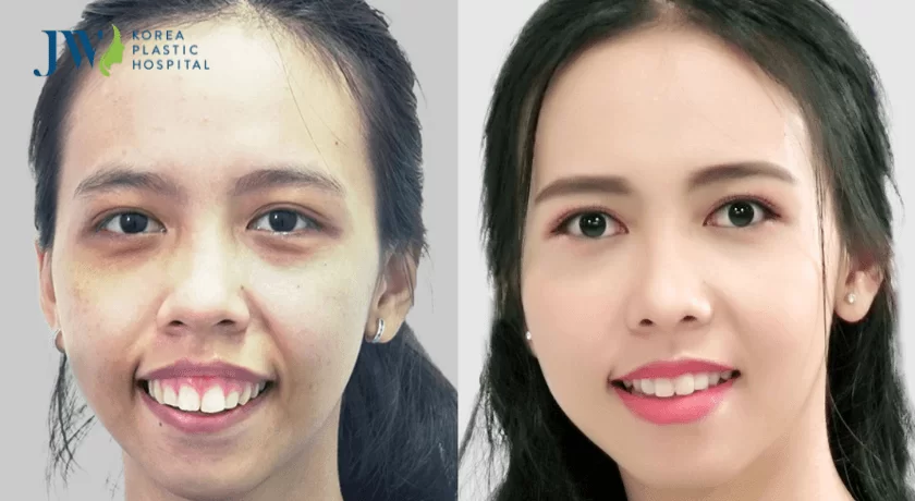 phẫu thuật thẩm mỹ răng hàm mặt
