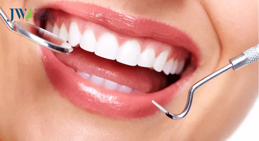 phẫu thuật thẩm mỹ răng hô