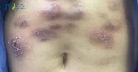 tiem tan mo hoai tu bung