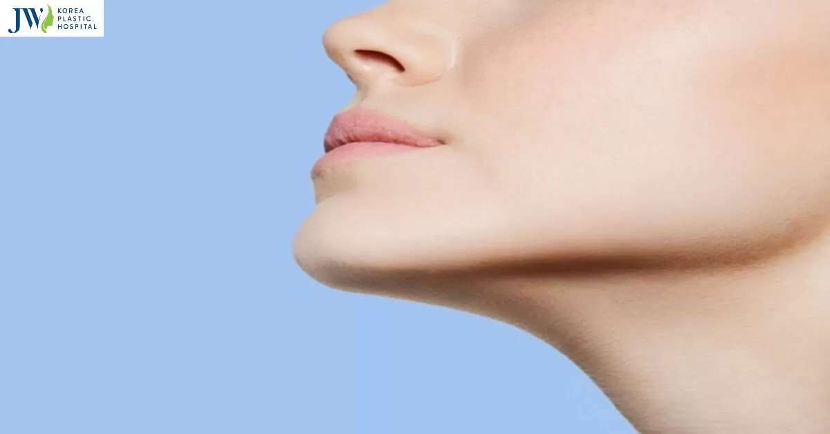 Kinh nghiệm phẫu thuật hàm hô – Giúp bạn tự tin trở thành mỹ nữ