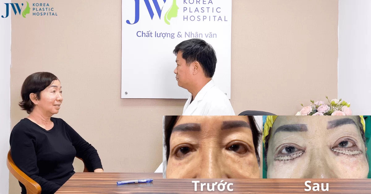Bị bạn thân dụ tiêm chất cấm Silicone nạn nhân bị chảy máu mắt suốt 40 năm