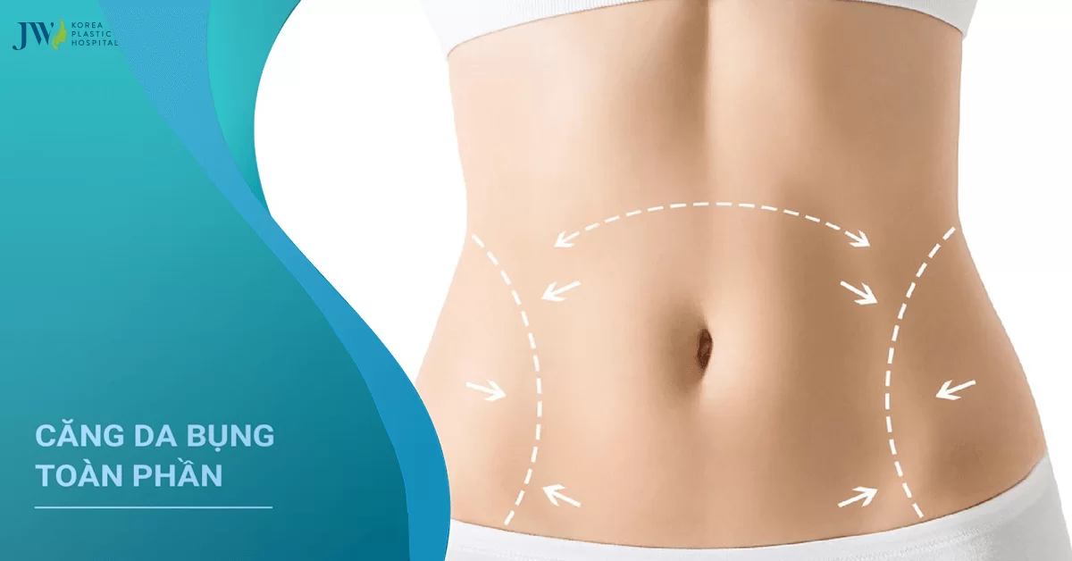 Căng da bụng: Quy trình chăm sóc và thực hiện phẫu thuật