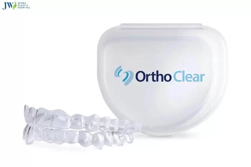 Những loại niềng răng trong suốt phổ biến nhất 2