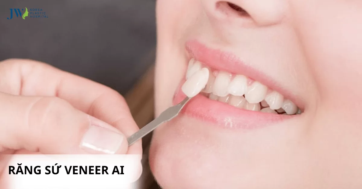 Răng sứ Veneer AI: Sự kết hợp hoàn hảo giữa thẩm mỹ và công nghệ