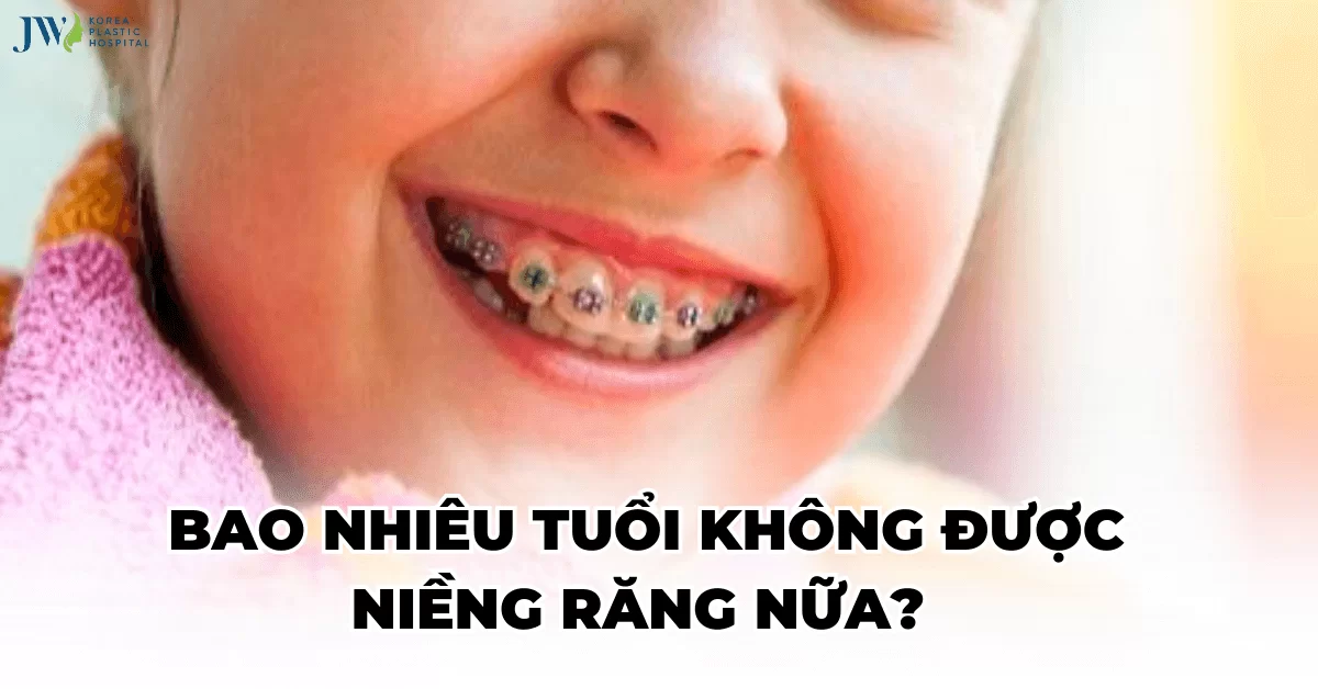 [ Giải đáp ] Bao nhiêu tuổi không được niềng răng nữa?