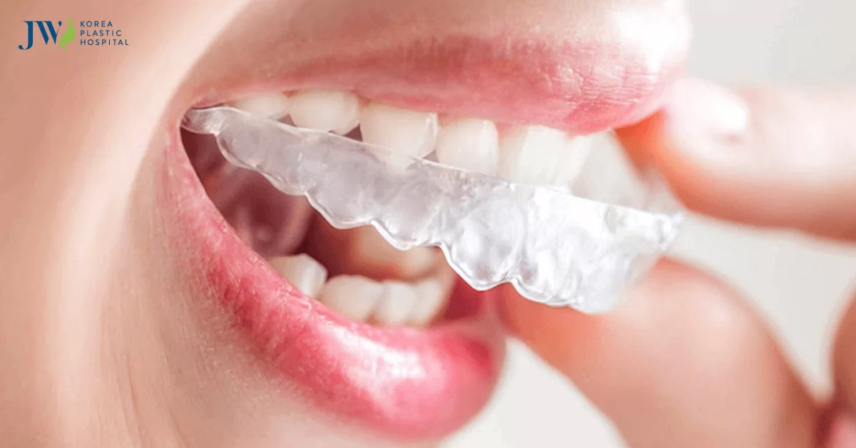 Đối tượng Niềng răng trong suốt AI là ai?