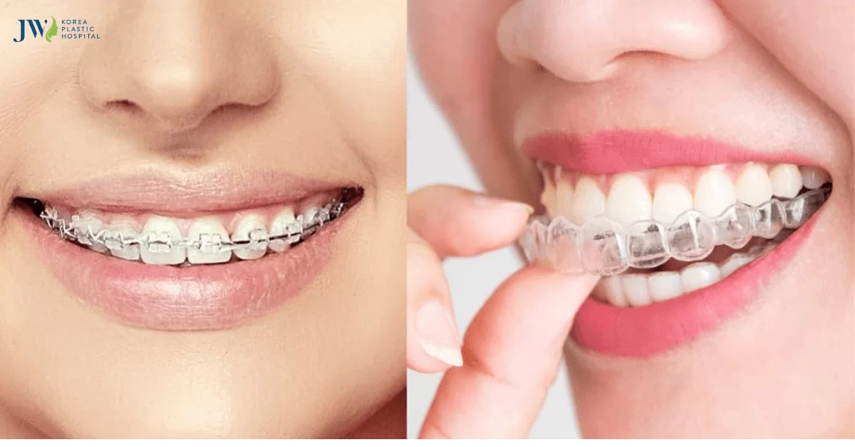 Những hiểu lầm về niềng răng trong suốt AI, bạn đã biết chưa?