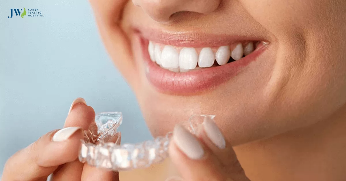 Khám phá máng niềng trong suốt AI hoạt động như thế nào?