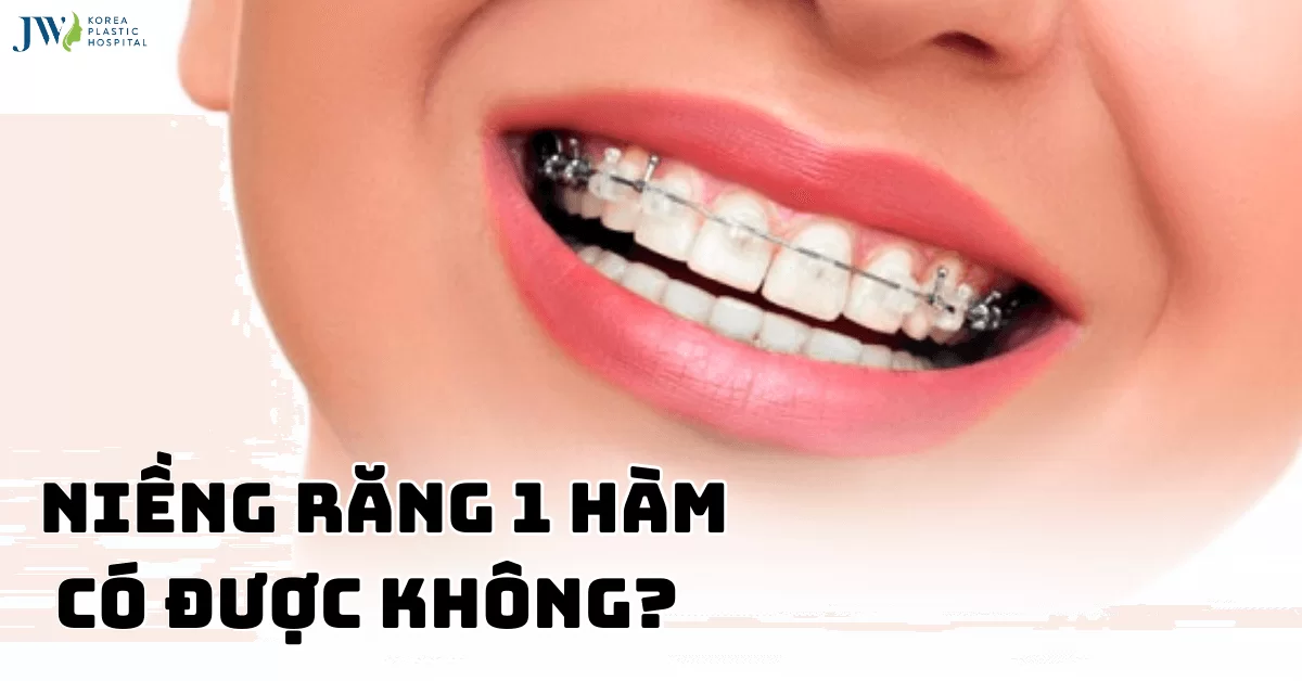 GIẢI ĐÁP THẮC MẮC: Niềng răng 1 hàm có được không?