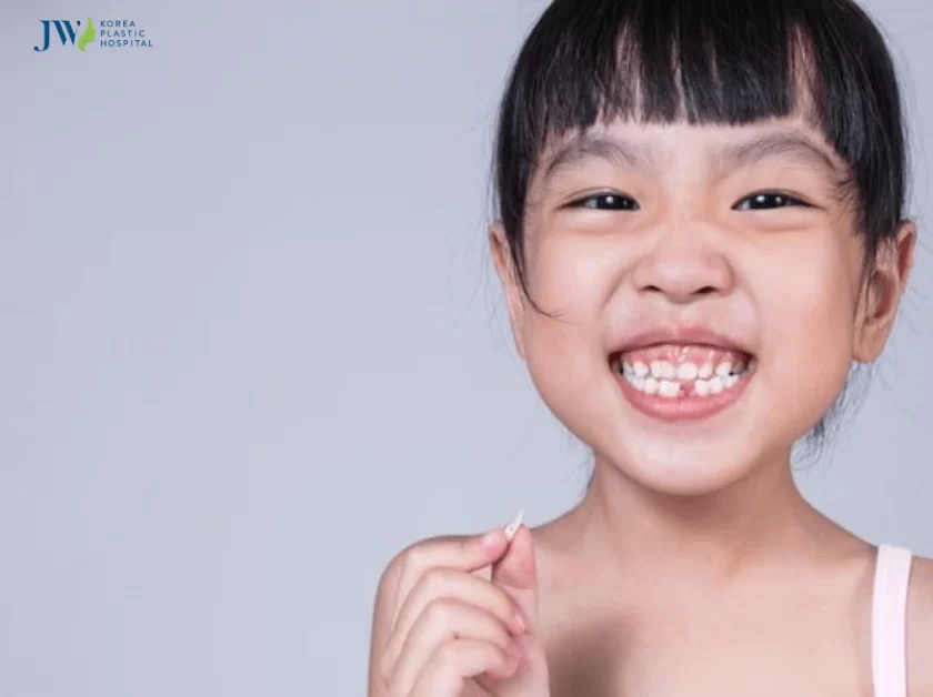 niềng răng cho trẻ 9 tuổi